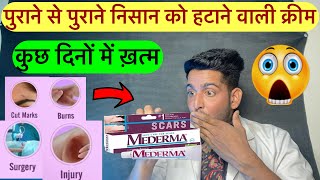 पुराने से पुराने निसान को हटाने वाली क्रीम  Mederma cream  Mederma advanced scar gel review  use [upl. by Rosario]