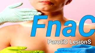 FNAC In Diagnosis Of Parotid Gland Lesions।। [upl. by Ulland]