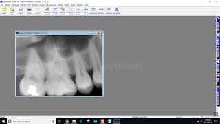 Training Apteryx XrayVision 4 Moving Images Between Patient Charts [upl. by Goulet3]