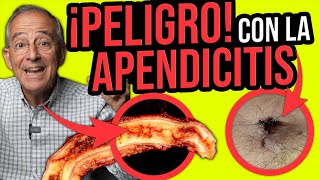 PELIGRO APENDICITIS RIESGO DE MUERTE POR ESTO SE ENFERMA EL APENDICE  Oswaldo Restrepo RSC [upl. by Alehtse]