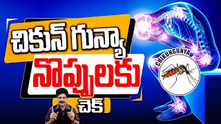 Get Rid of Chikungunya FAST with These Proven Home Remedies  చికున్ గున్యా నొప్పులకు చెక్ [upl. by Rorie475]