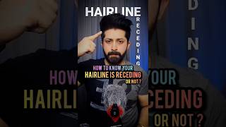 HOW TO KNOW YOUR HAIRLINE IS RECEDING OR NOT  shorts youtubeshorts menshair hairloss hairtips [upl. by Blodgett815]