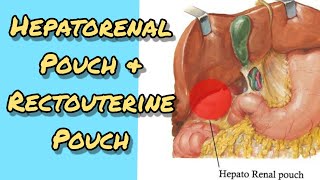 Hepatorenal pouch amp Rectouterine pouch [upl. by Aitekram]