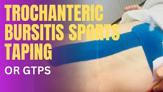 Trochanteric Bursitis or Greater Trochantertic Pain Syndrome Taping [upl. by Anujra]