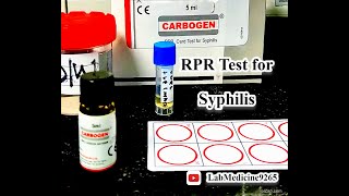 Rapid Plasma Reagin RPR Test  Serology  tulipdiagnosticspvtltdgoa [upl. by Urbas]