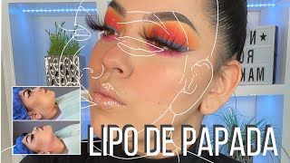 MI EXPERIENCIA CON LA LIPO DE PAPADA [upl. by Anedal]