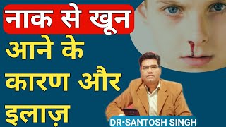 Naak Se Khoon Aane Ke Upay  Nose Bleeding EPISTAXIS Causes amp Treatment Explained [upl. by Sierra]