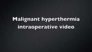 Malignant Hyperthermia Intraoperative video  Case Report [upl. by Pip432]