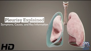 Pleurisy Unveiled Understanding Symptoms Causes and Vital Information [upl. by Shanleigh]