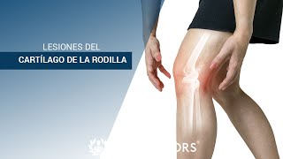 Lesiones del Cartílago de la Rodilla [upl. by Maryellen]