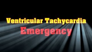 Ventricular Tachycardia Emergency [upl. by Siuqram]