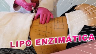 Resultados da Lipo Enzimática  Dr Luciane Bravi Explica [upl. by Bergerac]