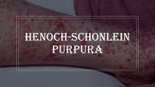 HenochSchonlein Purpura  purple rash on skin vasculitis [upl. by Adaha326]