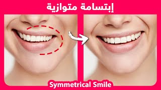 How to naturally fix smile asymmetry [upl. by Ryann]