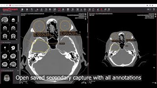 MedDream DICOM Viewer saving viewport content as DICOM secondary capture [upl. by Teilo]