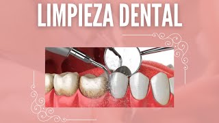 Limpieza Dental Pasó a pasó Destartraje profilaxis y aplicación de flúor tópico [upl. by Richers51]