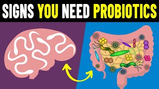 9 Signs You Need To Take Probiotics [upl. by Akiner]