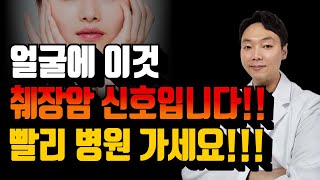 췌장암 전조증상 5가지 얼굴에 이런 증상 있으면 당장 병원으로 달려가세요 [upl. by Ateekram]