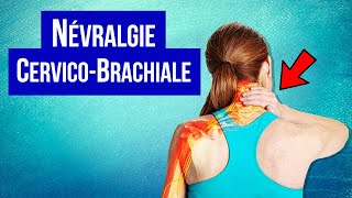 Névralgie cervicobrachiale  Symptôme et Traitement [upl. by Nuahsad812]