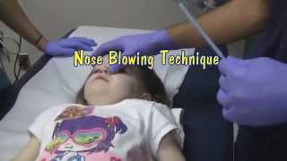 Nasoendoscopy Nose Examination  ENT [upl. by Gates]