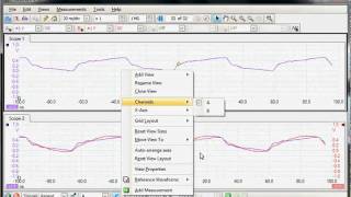 PicoScope 6 Viewing Waveforms [upl. by Beutner]