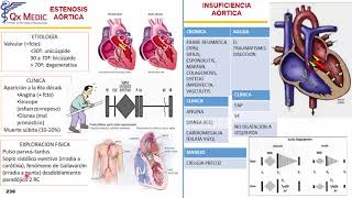 Valvulopatías [upl. by Anehsak135]