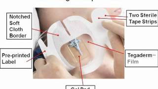 3M™ Tegaderm™ CHG Part 1  Basics [upl. by Swan456]