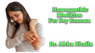 Homeopathic Medicine For Dry Eczema  Dr Abha Bhalla [upl. by Negah241]