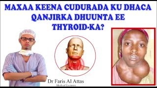 MAXAA KEENA CUDURADA KU DHACA QANJIDKA DHUUNTA EE THYROIDKA Hypo and Hyperthroidsm Dr faris [upl. by Chaffinch]