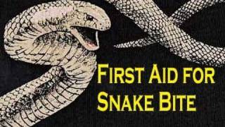 Snake Artist First aid for snake bite Australia [upl. by Yrrag577]