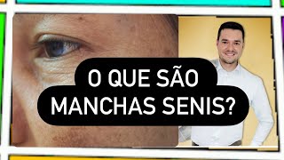 MANCHAS SENIS O que são [upl. by Lindbom]