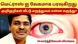 madras eye treatment symptoms home remedies in tamil   dr karthikeyan [upl. by Caz]