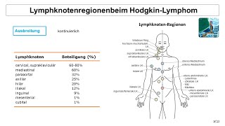 Lymphknotenregionen beim Hodgkin Lymphom  Strahlentherapie Prof Hilke Vorwerk [upl. by Eneiluj]