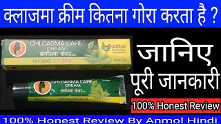 Chloasma Care Cream Full Review By Anmol Hindi [upl. by Ena147]