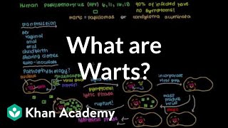 What are warts  Infectious diseases  NCLEXRN  Khan Academy [upl. by Carmelo606]