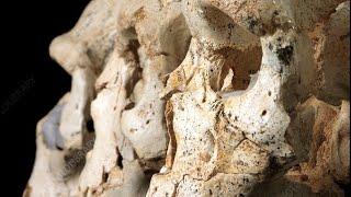 Unveiling the Neanderthal Connection How Ancient Genes Influence Autism Today [upl. by Elkraps734]