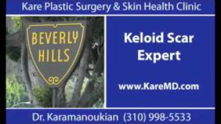 Keloid Scar Burn Scar Hypertrophic Scar Expert in Los Angeles [upl. by Cybill]