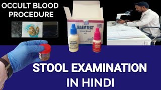 Stool Examination  Stool Microscopic Examination  माल की जांच  Stool Occult Blood Test [upl. by Enitsed]