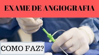 exame de angiografia como faz [upl. by Allebram]