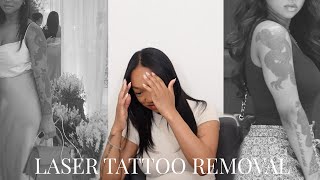 I regret my Tattoos  Im getting them ALL REMOVED  Tattoo Removal Journey [upl. by Ailegra133]