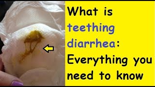 What is teething diarrhoea Everything you need to know [upl. by Belva]