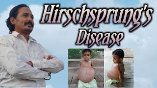 Hirschsprungs disease dha moh prometric [upl. by Akehsat10]