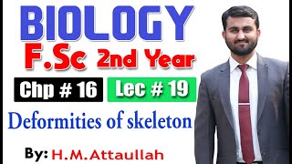 Deformities of skeleton  Chapter 16  2nd year Biology  Lec  19 [upl. by Terriss629]