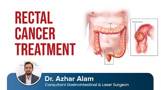 Rectal Cancer Diagnosis and Treatment by Dr Azhar Alam [upl. by Brigida120]