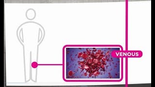 Venous Thrombosis Explained [upl. by Rubi]