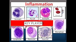 pathology general Inflammation practical [upl. by Aisinut]