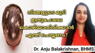 Alopecia areata in malayalam  Hair loss treatment in malayalam  Home remedies for alopecia areata [upl. by Bela]