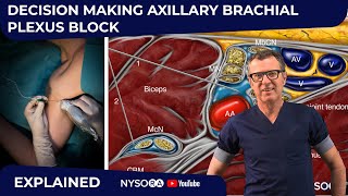 Axillary Block Decision Making Explained  Crash course with Dr Hadzic [upl. by Siuqcram]