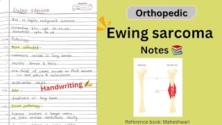 Ewing sarcoma notes 📚 Orthopedic  physiotherapy 3rd Yr 🔥 [upl. by Idnic141]