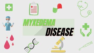 Myxedema Definition Symptoms Diagnosis Treatment [upl. by Feingold994]